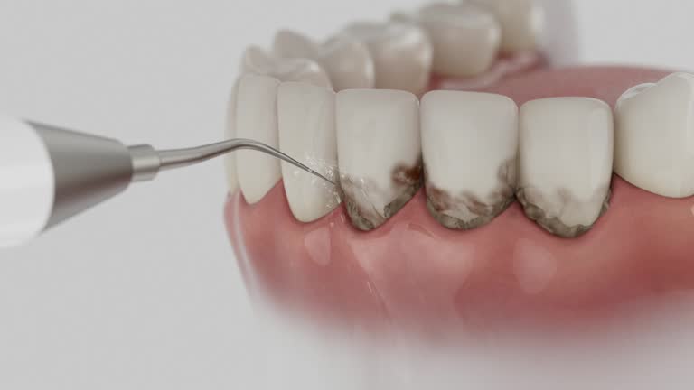 Trusted Tooth Extraction service in Leesburg, OH - Dentist Open Now